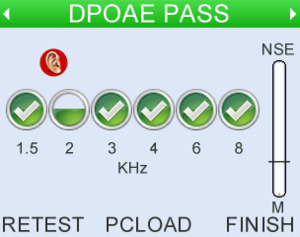 Configurable as a simple-to-use DPOAE and TEOAE (if enabled) automated screener
