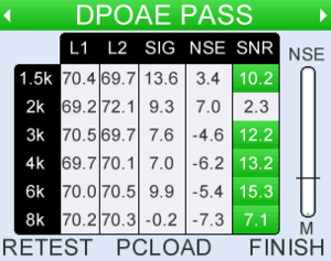 Detailed numerical data available with each test result. Stimulus, response noise levels plus signal to noise ration SNR