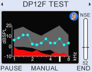 High quality 12 frequency bar DPgrams or higher resolution with normative range markers from 1-8kHz up to 4pts/octave and or higher resolution.
