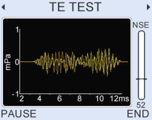 View TEOAE waveform.

