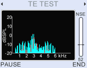 Comprehensive TEOAE analysis, high resolution spectrum