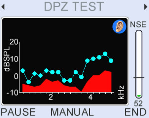 DP zoom focuses on a specific range of frequencies in high resolution (up to 16 pts/oct) to explore details.