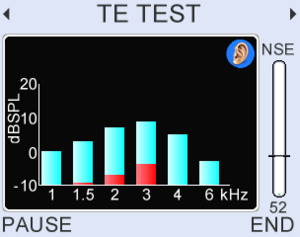 Increase the depth and power
of your clinical investigations by adding our gold-standard 
1-6kHz TEOAE analysis with half octave analysis between 0.8-6kHz and waveform display.