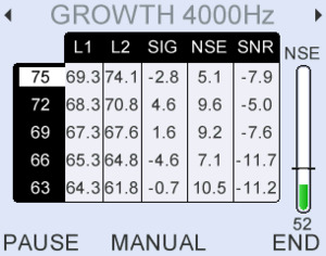 Detailed numerical data available with each test result. Stimulus, response noise levels plus signal to noise ration SNR.