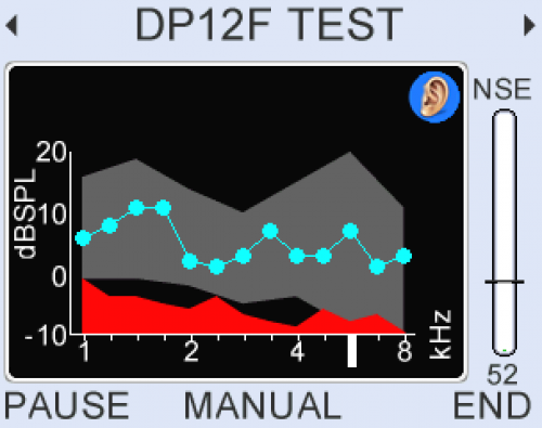 DP 12 FREQUENCY TEST